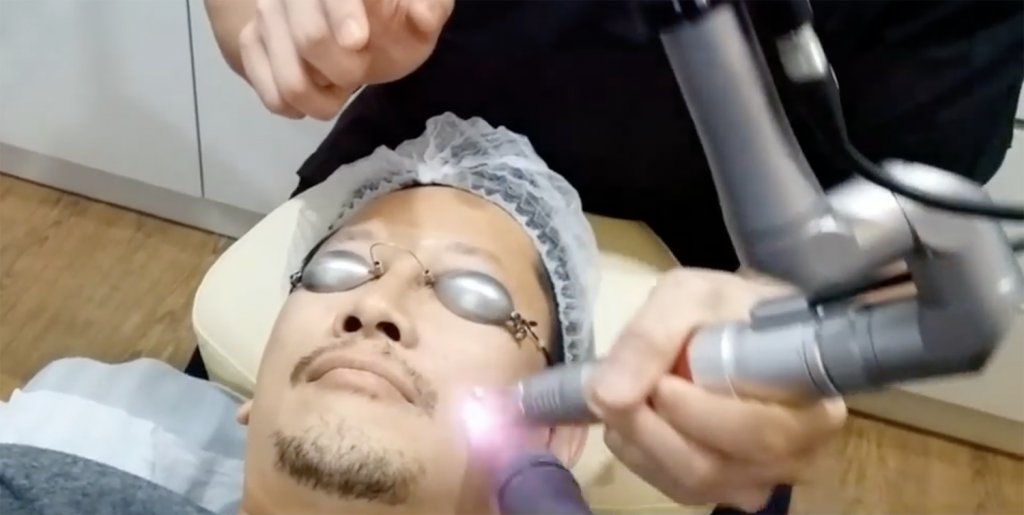 laser light emitted to treat dull skin
