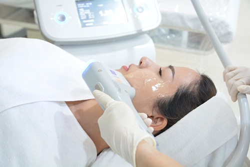 Ultherapy High Intensity Focused Ultrasound