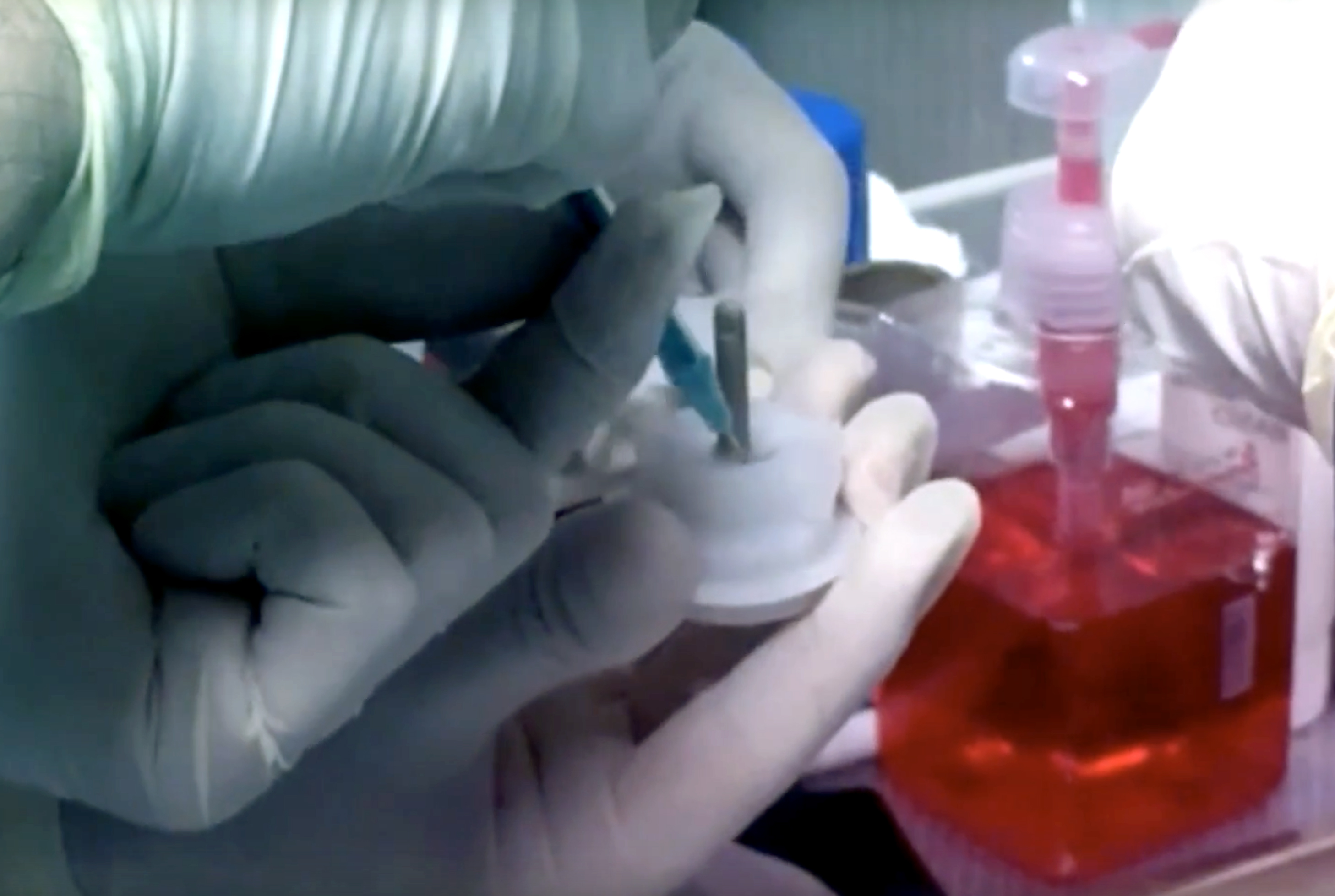 stem cell treatment denver stem cell treatment denver