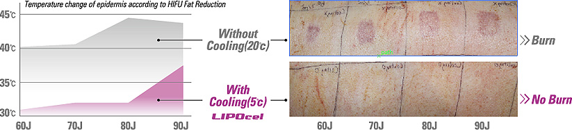 LIPOCEL Treatment Effect