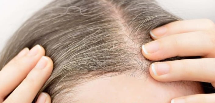 Thinning hair and dry skin