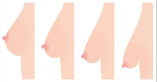 Aging Saggy Breasts