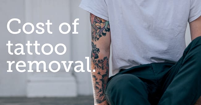Cost of Tattoo Removal