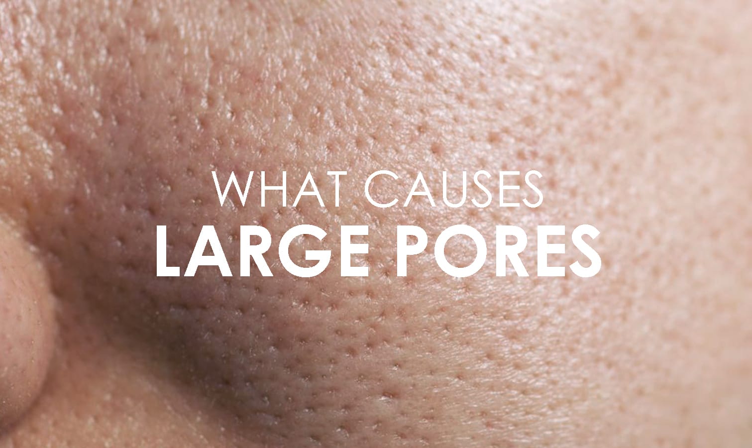 large pores on breasts