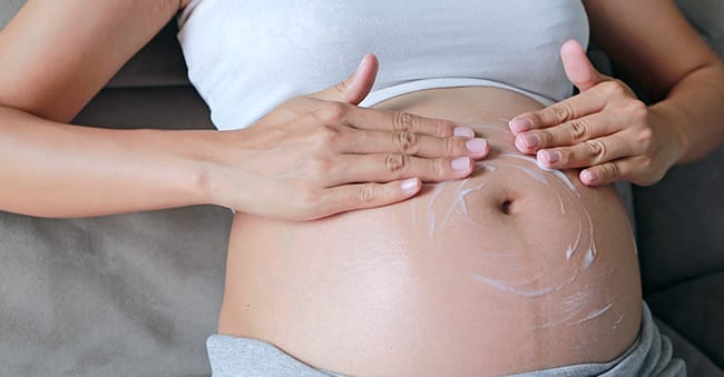 Prevent Stretch Marks During Pregnancy