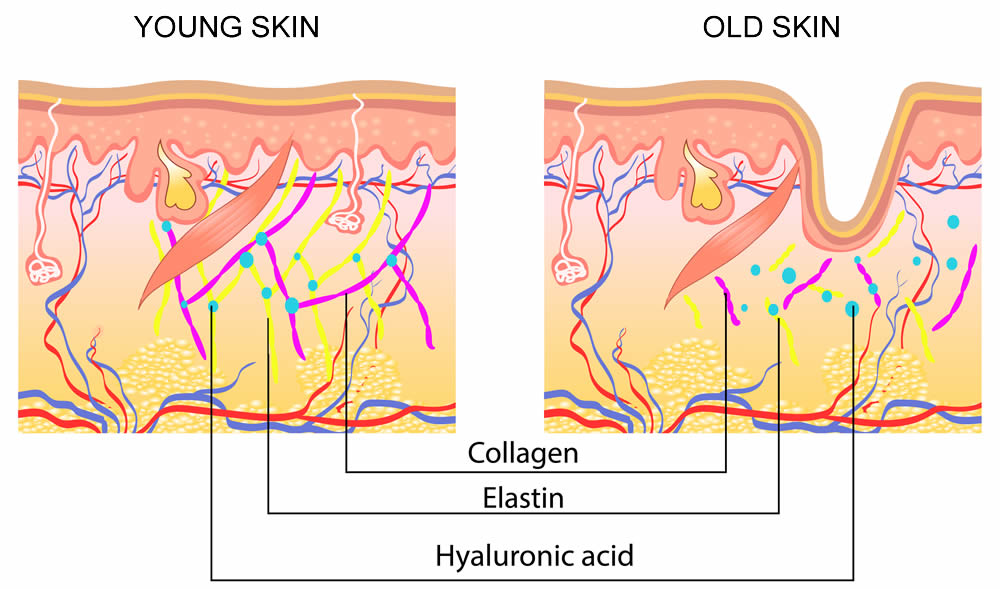 young-skin-old-skin