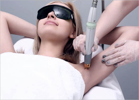 CANDELA GENTLE YAG LASER TREATMENT