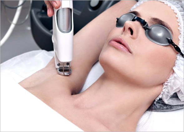 CANDELA GENTLE YAG LASER TREATMENT 08