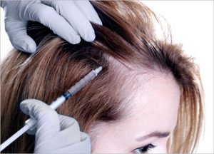 HAIR FILLER GEL – HAIR TREATMENT
