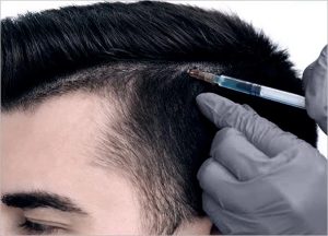 HAIR FILLER GEL – HAIR TREATMENT