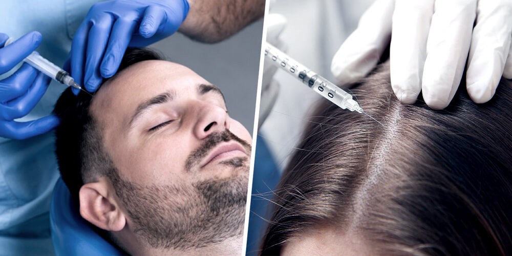 Hair Loss Treatments - Hair Stem Cell