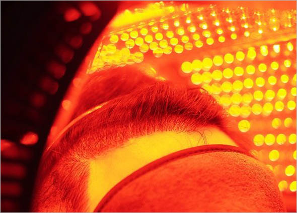 LED Photomodulation Therapy