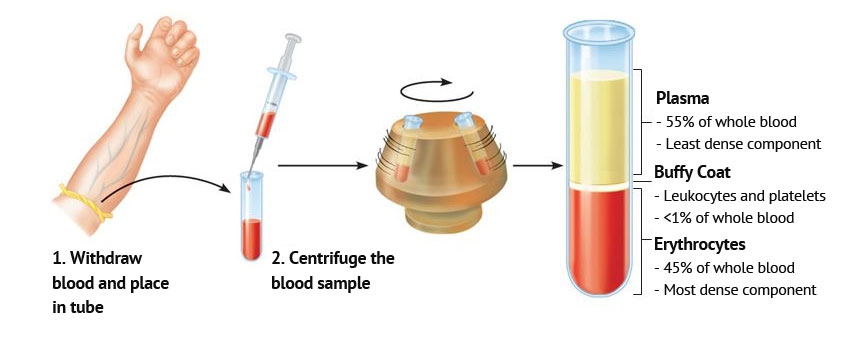 What is Platelet-rich Plasma