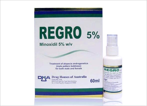 Regro Hair Spray - Hair Loss Treatment - Premier Clinic