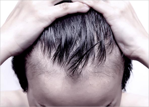 Regro Hair Spray - Hair Loss Treatment - Premier Clinic