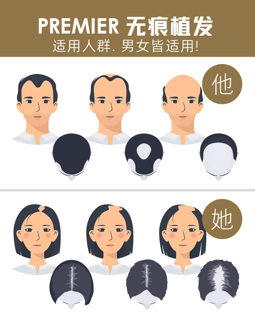 适用人群与治疗需求