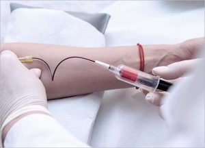 What is Platelet-rich Plasma