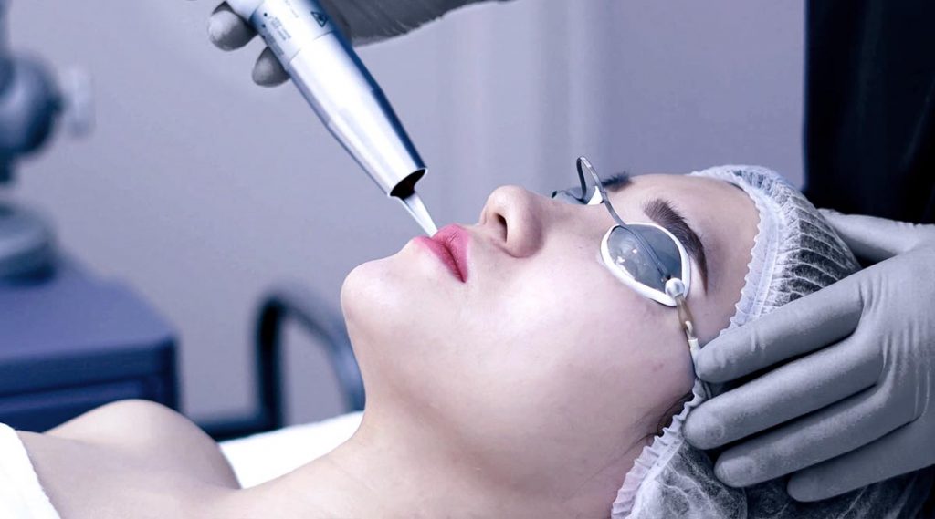What is Q-switch Nd: YAG Laser