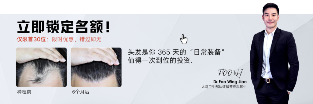无痕植发 头发移植