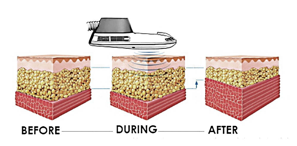 Functional Muscle System