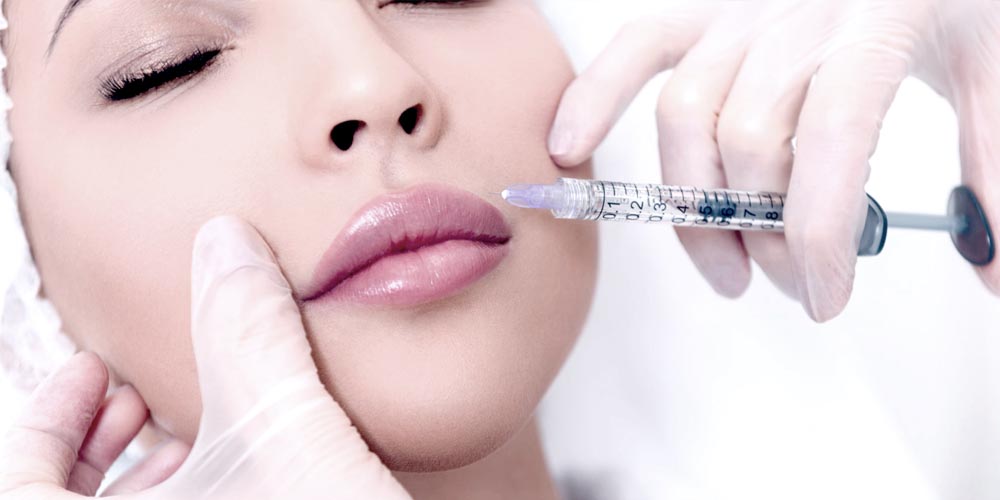 LIP FILLER : SECRET TO THE PERFECT POUT