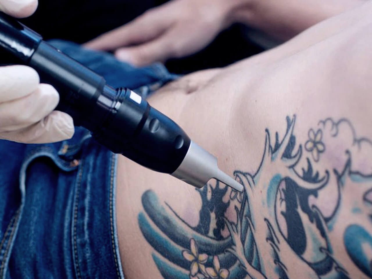 Permanent Tattoo Removal With Premier Pico Laser