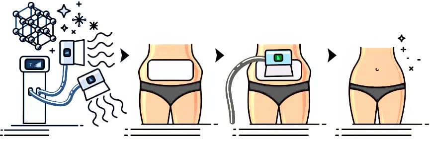 how fat freezing works
