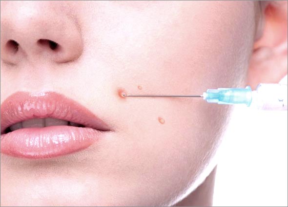 Acne & Scar Treatment - Intralesion Cortisone Injection | Premier Clinic