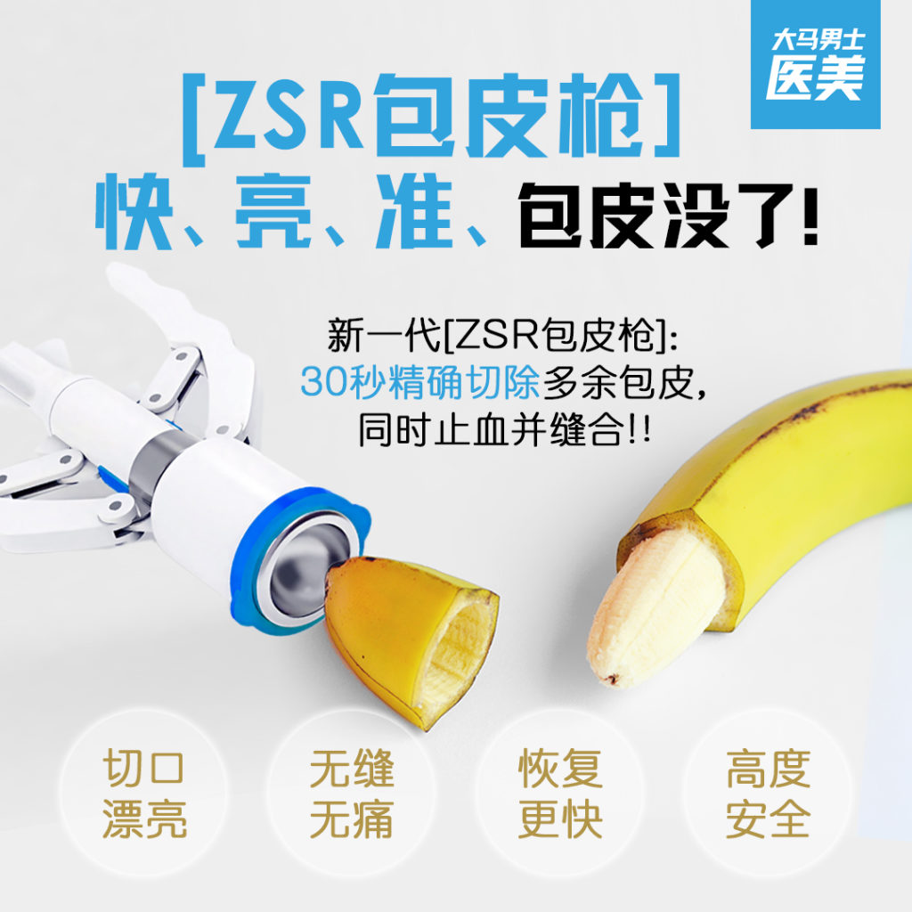 ZSR 免缝合成人包皮环切术