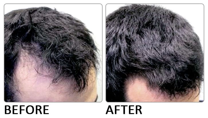 Pristine Vital Hair Serum (50ml) - Premier Clinic