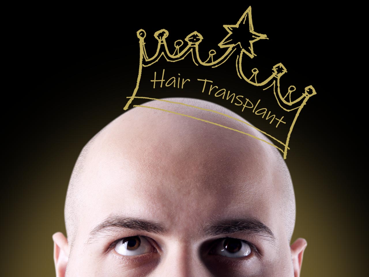 SureGrow Hair Transplant