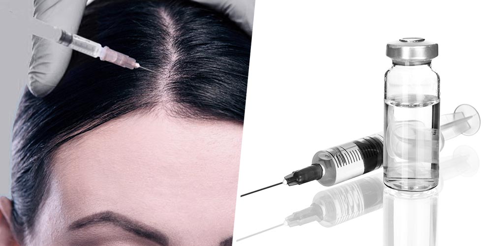 Premier Hair Loss Treatment - MESOTHERAPY
