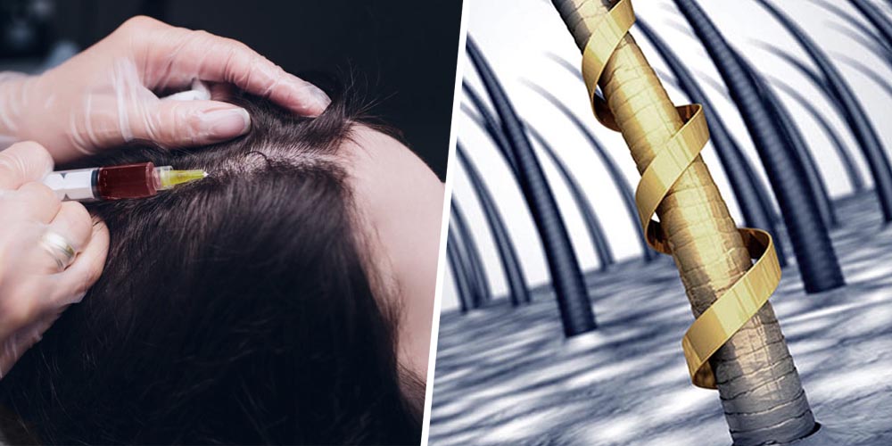Premier Hair Loss Treatment - STEM CELL THERAPY