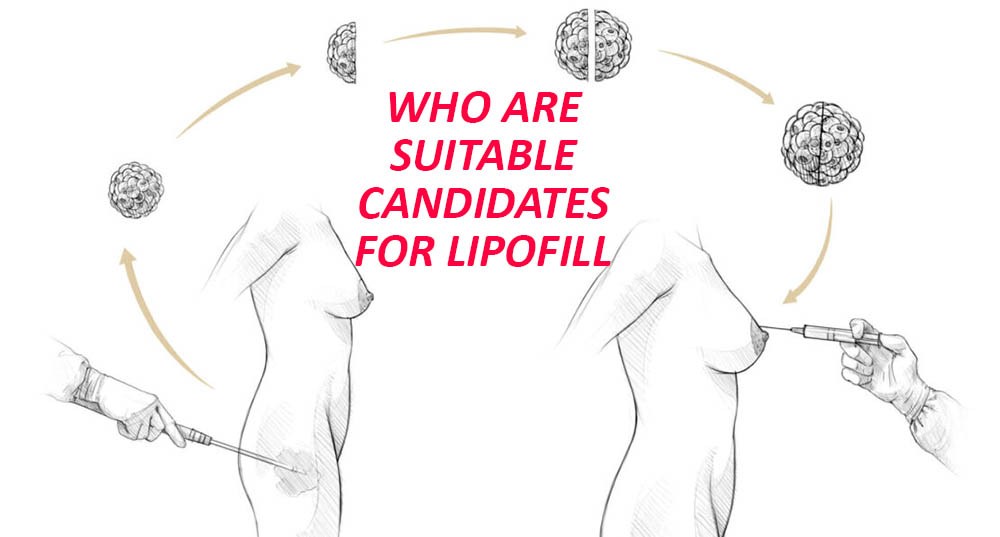 WHO ARE SUITABLE CANDIDATES FOR LIPOFILL