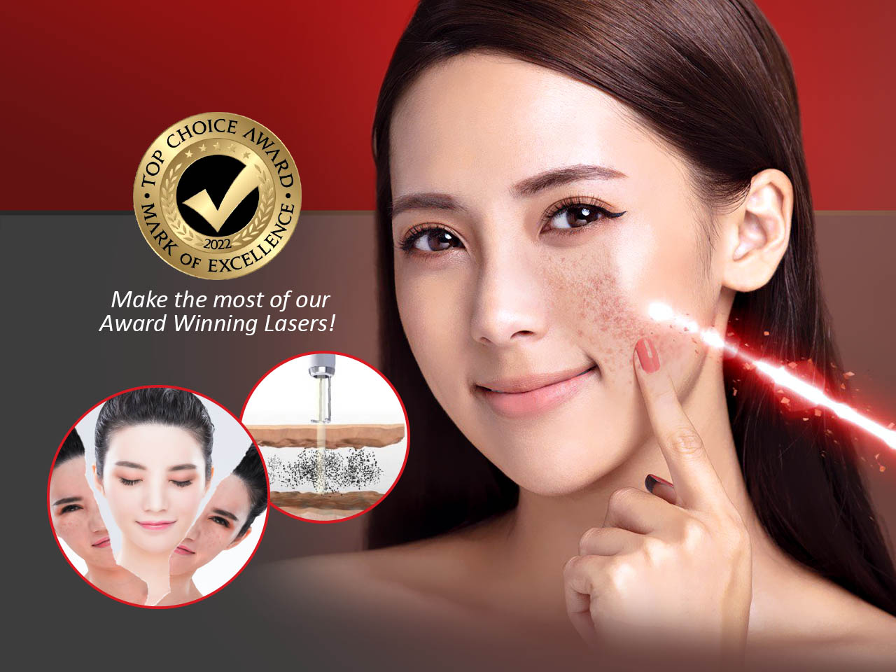 Buy 2 Free 1 For All Skin Laser Treatments