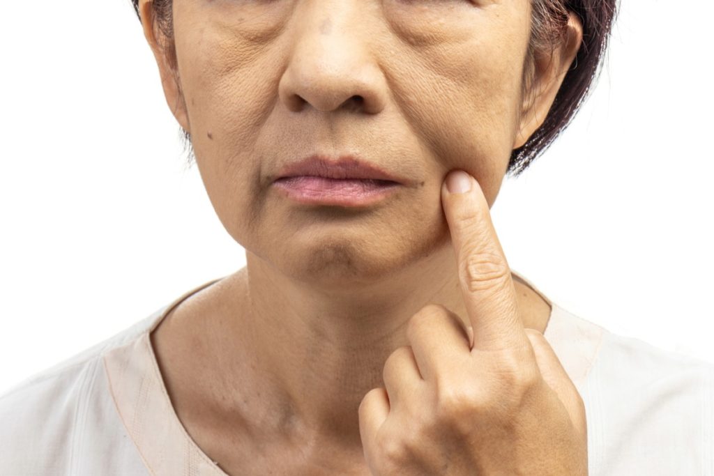 脸部松弛下垂怎么办