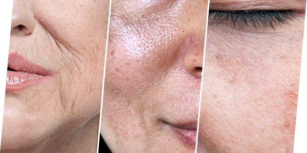 WHO IS SUITABLE SKIN BOOSTERS