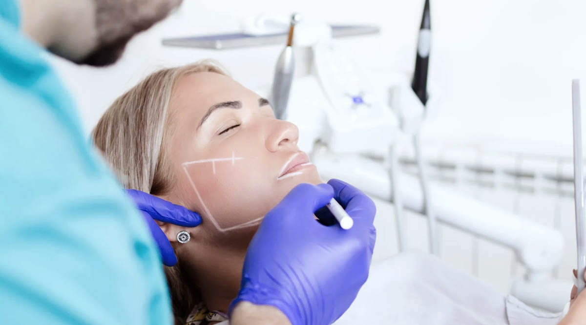 Buccal Fat Removal Surgery 