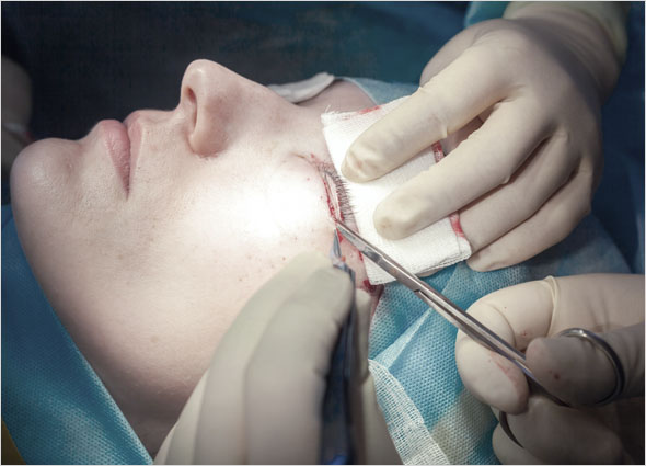 Lower Blepharoplasty - Eyebag Surgery