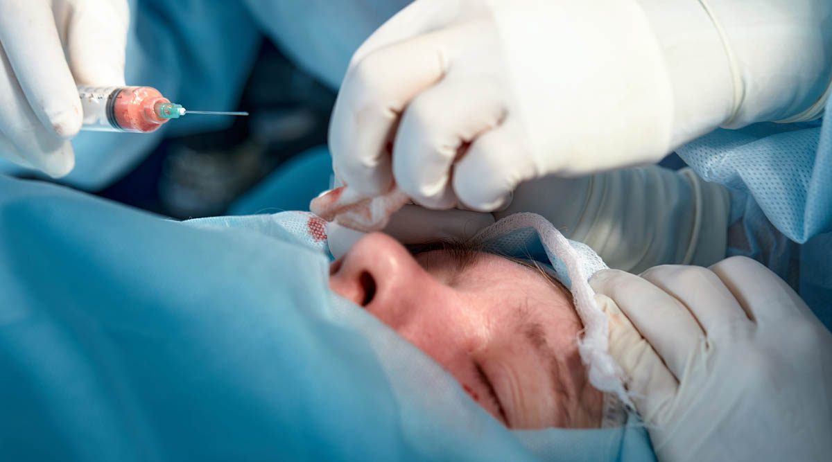 Lower Blepharoplasty - Eyebag Surgery 