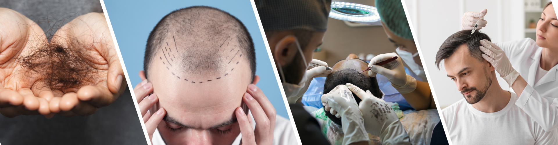 Hair loss